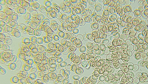 Mikroskopi 6 - Blod - Biologiforbundet