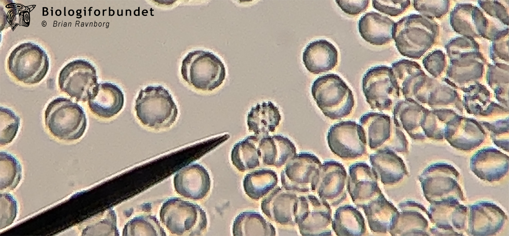 Mikroskopi 6 - Blod - Biologiforbundet
